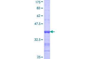 ACSL1 Protein (AA 48-145) (GST tag)