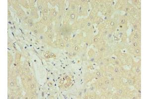 Immunohistochemistry of paraffin-embedded human liver tissue using ABIN7158666 at dilution of 1:100 (LYRM1 antibody  (AA 1-122))