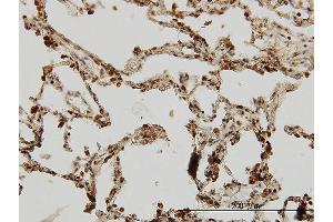 Immunoperoxidase of monoclonal antibody to IRAK1 on formalin-fixed paraffin-embedded human lung. (IRAK1 antibody  (AA 530-693))
