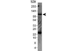 Western blot analysis of WNK4 in mouse kidney lysate with WNK4 polyclonal antibody . (WNK4 antibody  (AA 200-300))