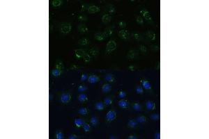 Immunofluorescence analysis of C6 cells using COPG2 Polyclonal Antibody (ABIN7266425) at dilution of 1:100 (40x lens). (COPG2 antibody  (AA 542-871))