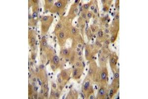 Immunohistochemistry analysis in formalin fixed and paraffin embedded human liver tissue reacted with PAGE5 Antibody (C-term) followed which was peroxidase conjugated to the secondary antibody and followed by DAB staining. (PAGE5 antibody  (C-Term))