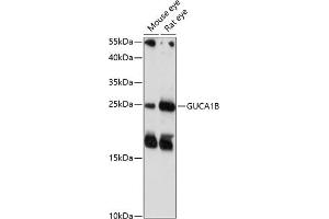 Western blot analysis of extracts of various cell lines, using GUCB antibody (4739) at 1:1000 dilution. (GUCA1B antibody  (AA 1-200))
