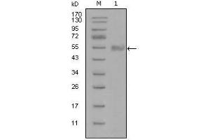 Western Blot showing SYT1 antibody used against truncated Trx-SYT1 recombinant protein (1). (SYT1 antibody)