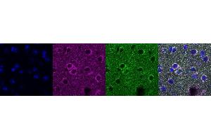 Immunohistochemistry (IHC) image for anti-ATP Synthase, H+ Transporting, Mitochondrial F1 Complex, alpha Subunit 1, Cardiac Muscle (ATP5A1) antibody (ABIN7456312)