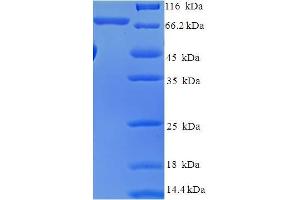 SDS-PAGE (SDS) image for V-Akt Murine Thymoma Viral Oncogene Homolog 2 (AKT2) (AA 2-481) protein (His-SUMO Tag) (ABIN5709031)