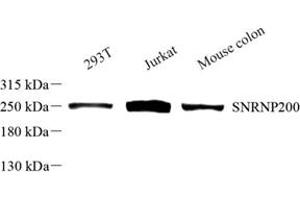 Western blot analysis of SNRNP200 (ABIN7075632) at dilution of 1: 500
