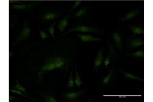 Immunofluorescence of monoclonal antibody to PMS2 on HeLa cell. (PMS2 antibody  (AA 763-862))
