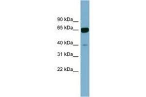 Image no. 1 for anti-Zinc Finger Protein 169 (ZNF169) (AA 71-120) antibody (ABIN6742078) (ZNF169 antibody  (AA 71-120))