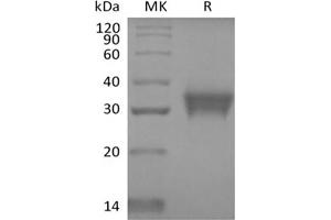 Western Blotting (WB) image for Stanniocalcin 1 (STC1) protein (His tag) (ABIN7319806) (Stanniocalcin 1 Protein (STC1) (His tag))