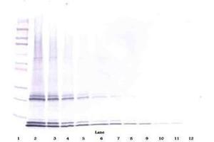 Image no. 2 for anti-Interleukin 15 (IL15) antibody (ABIN465267) (IL-15 antibody)