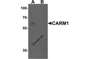 Western Blotting (WB) image for anti-Coactivator-Associated Arginine Methyltransferase 1 (CARM1) (N-Term) antibody (ABIN1077435) (CARM1 antibody  (N-Term))