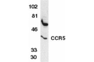 Image no. 2 for anti-Chemokine (C-C Motif) Receptor 5 (CCR5) (AA 6-20) antibody (ABIN319017) (CCR5 antibody  (AA 6-20))