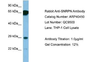 WB Suggested Anti-SNRPN Antibody   Titration: 1. (SNRPN antibody  (N-Term))