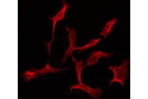 ABIN6274609 staining NIH-3T3 by IF/ICC. (CADM3 antibody  (Internal Region))