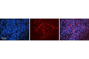 Rabbit Anti-HNRNPU Antibody   Formalin Fixed Paraffin Embedded Tissue: Human Testis Tissue Observed Staining: Cytoplasm and nucleus in spermatogonia and spermatocytes Primary Antibody Concentration: N/A Other Working Concentrations: 1:600 Secondary Antibody: Donkey anti-Rabbit-Cy3 Secondary Antibody Concentration: 1:200 Magnification: 20X Exposure Time: 0. (HNRNPU antibody  (N-Term))