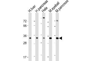 All lanes : Anti-SFRP5 Antibody (Center) at 1:2000 dilution Lane 1: Human liver lysate Lane 2: Human pancreas lysate Lane 3: Hela whole cell lysate Lane 4: Mouse eyeball lysate Lane 5: Mouse pancreas lysate Lysates/proteins at 20 μg per lane. (SFRP5 antibody  (AA 190-219))