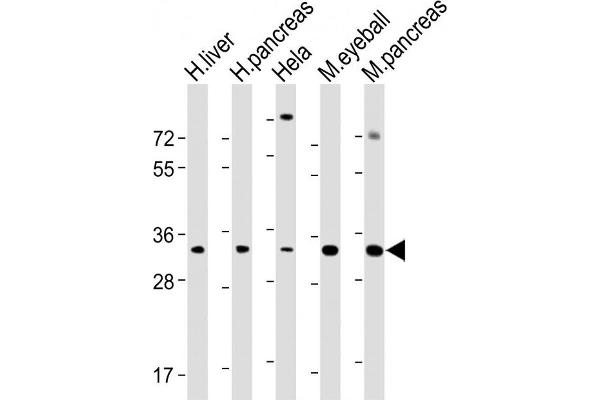 SFRP5 antibody  (AA 190-219)