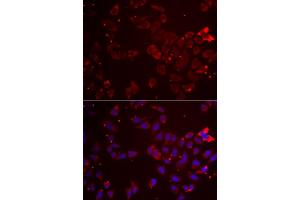 Immunofluorescence analysis of A549 cells using GATM antibody (ABIN5973965). (GATM antibody)