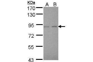 WB Image Sample (30 ug of whole cell lysate) A: A431 , B: H1299 7. (LIMK2 antibody)