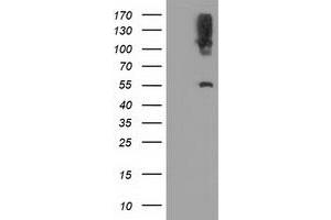 Western Blotting (WB) image for anti-Lipase, Endothelial (LIPG) antibody (ABIN1499173) (LIPG antibody)