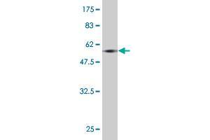 Western Blot detection against Immunogen (55. (HOXA9 antibody  (AA 1-272))