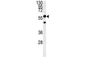 Western Blotting (WB) image for anti-phosphoglycerate Dehydrogenase (PHGDH) (AA 249-277) antibody (ABIN3032220)