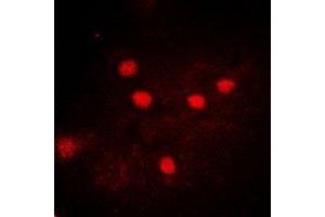 Immunofluorescent analysis of USP26 staining in A549 cells. (USP26 antibody)