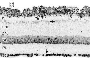 Immunocytochemical localization of the adrenomedullin (ADM) receptor calcitonin receptor like receptor (CRLR) and receptor activity modifying protein (RAMP2). (RAMP2 antibody  (C-Term))