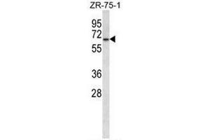 GPD2 Antibody (C-term) western blot analysis in ZR-75-1 cell line lysates (35µg/lane). (GPD2 antibody  (C-Term))