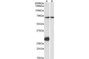 ABIN571078 (1µg/ml) staining of Mouse Heart (A) and Liver (B) lysate (35µg protein in RIPA buffer). (CPT2 antibody  (AA 141-154))