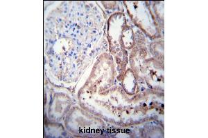 SCDGFB Antibody (Center) (ABIN390196 and ABIN2840684) immunohistochemistry analysis in formalin fixed and paraffin embedded human kidney tissue followed by peroxidase conjugation of the secondary antibody and DAB staining. (PDGFD antibody  (AA 313-341))