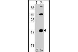 Western blot analysis of CD247 (arrow) using rabbit CD247 polyclonal antibody . (CD247 antibody  (C-Term))