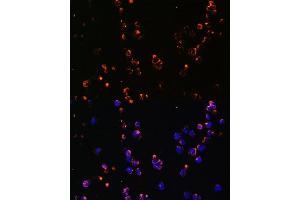 Immunofluorescence analysis of Jurkat cells using CD27 antibody (ABIN3022680, ABIN3022681, ABIN3022682 and ABIN6219092) at dilution of 1:100. (CD27 antibody  (AA 20-191))