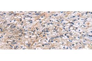 Immunohistochemistry of paraffin-embedded Human brain tissue using CEP89 Polyclonal Antibody at dilution of 1:95(x200) (CEP89 antibody)