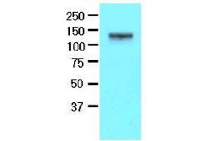 Western Blotting (WB) image for anti-EPH Receptor A2 (EPHA2) (AA 559-976) antibody (ABIN317512) (EPH Receptor A2 antibody  (AA 559-976))