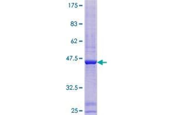 ATAD1 Protein (AA 1-151) (GST tag)