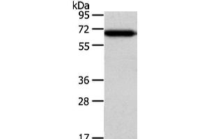 Western Blot analysis of Hepg2 cell using USP39 Polyclonal Antibody at dilution of 1/400 (USP39 antibody)