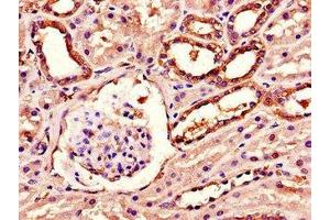 Immunohistochemistry of paraffin-embedded human kidney tissue using ABIN7143254 at dilution of 1:100 (Acylglycerol Kinase antibody  (AA 32-65))