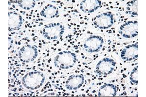 Immunohistochemical staining of paraffin-embedded colon tissue using anti-CNDP1mouse monoclonal antibody. (CNDP1 antibody)