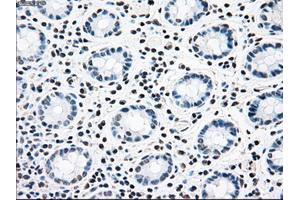 Immunohistochemical staining of paraffin-embedded colon tissue using anti-CNDP1mouse monoclonal antibody.