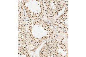 (ABIN6243447 and ABIN6578904) staining METTL14 in human testis tissue sections by Immunohistochemistry (IHC-P - paraformaldehyde-fixed, paraffin-embedded sections). (METTL14 antibody  (AA 2-36))