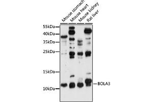 Western blot analysis of extracts of various cell lines, using BOL antibody (ABIN7265891) at 1:1000 dilution. (BOLA3 antibody  (AA 1-68))