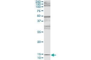 Immunoprecipitation of PTH transfected lysate using mouse monoclonal anti-PTH and Protein A Magnetic Bead (PTH (Human) IP-WB Antibody Pair)