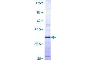 CNOT7 Protein (AA 1-100) (GST tag)