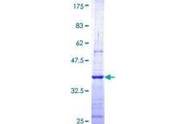 CNOT7 Protein (AA 1-100) (GST tag)