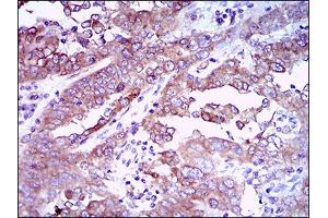Immunohistochemistry (IHC) image for anti-Epidermal Growth Factor Receptor (EGFR) (AA 693-893) antibody (ABIN1724890)