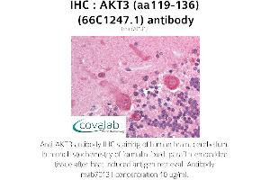 Image no. 1 for anti-V-Akt Murine Thymoma Viral Oncogene Homolog 3 (Protein Kinase B, Gamma) (AKT3) (AA 119-136) antibody (ABIN1723080) (AKT3 antibody  (AA 119-136))
