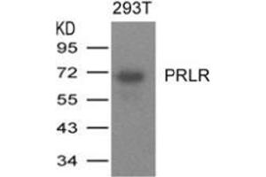 Western blot analysis of extracts from 293T cells expressing human PRLR protein using PRLR. (Prolactin Receptor antibody  (AA 25-29))