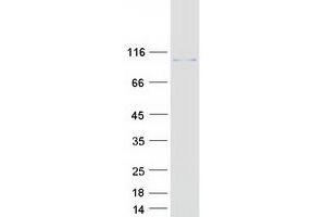 Validation with Western Blot (CALCOCO1 Protein (Transcript Variant 1) (Myc-DYKDDDDK Tag))